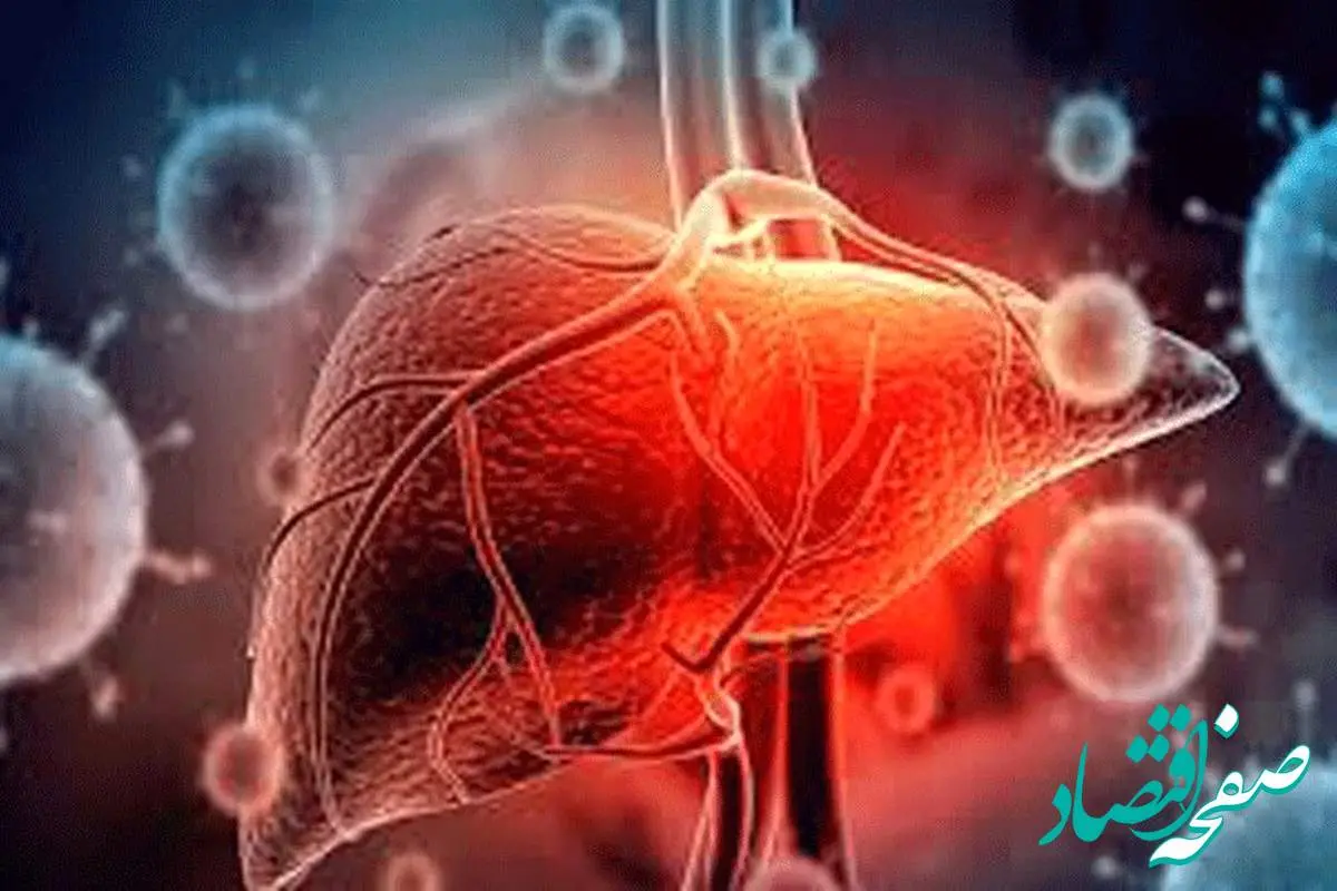 بدون خوردن دارو کبد چرب را درمان کنید