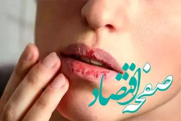 بخوانید تا بدانید خشکی دهان نشانه کدام بیماری است