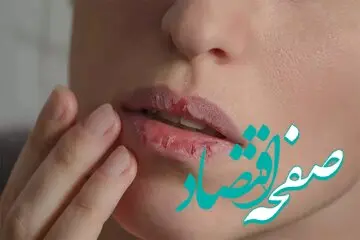 بخوانید تا بدانید خشکی دهان نشانه کدام بیماری است