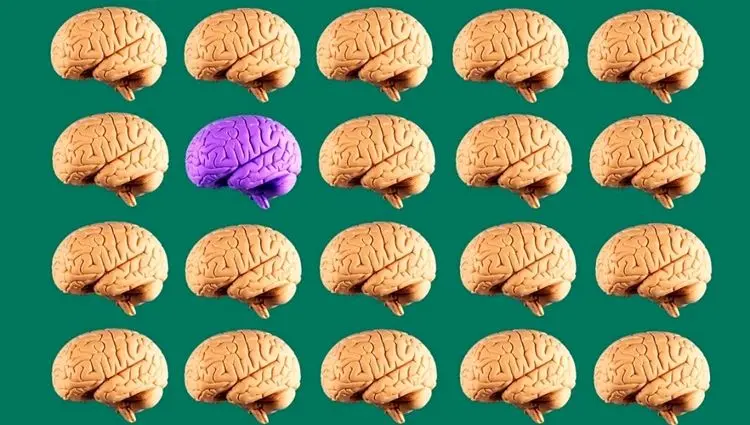 اختراع عجیب هوش مصنوعی گوگل: شبیه‌سازی بخش ناشناخته مغز!