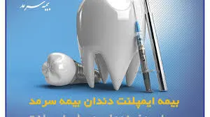 بیمه ایمپلنت بیمه سرمد ضامن لبخندی سالم و زیبا برای شما