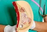 لکه‌های سفید روی سینه، علامت خطر یا مشکل ساده؟ بخوانید!
