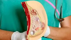 لکه‌های سفید روی سینه، علامت خطر یا مشکل ساده؟ بخوانید!