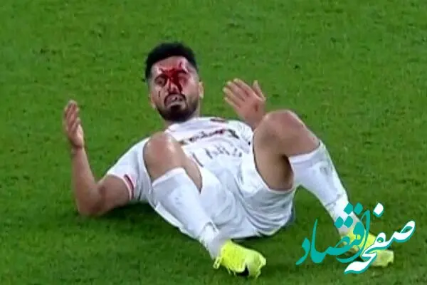 رئیس‌جمهور پرسپولیس مصدوم شد | پرسپولیس کاپیتانش را در نیم فصل اول نخواهد داشت