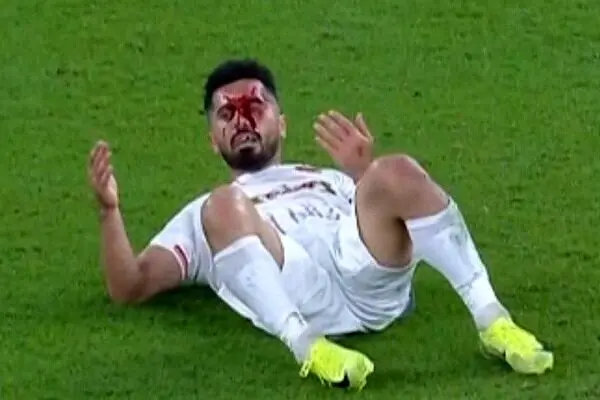 رئیسجمهور پرسپولیس مصدوم شد | پرسپولیس کاپیتانش را در نیم فصل اول نخواهد داشت