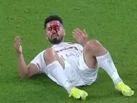 رئیس‌جمهور پرسپولیس مصدوم شد | پرسپولیس کاپیتانش را در نیم فصل اول نخواهد داشت