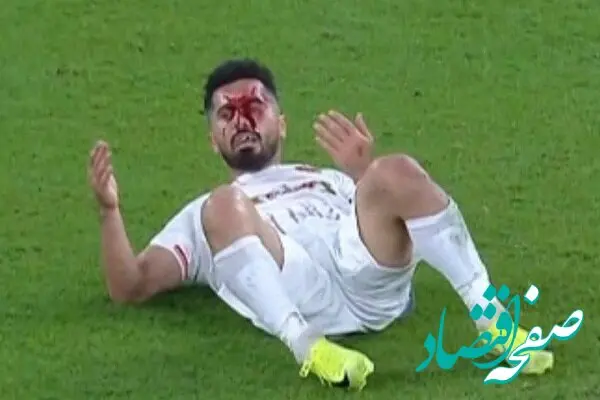 رئیس‌جمهور پرسپولیس مصدوم شد | پرسپولیس کاپیتانش را در نیم فصل اول نخواهد داشت